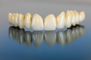 Porcelain teeth - dental bridge