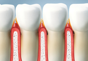 treat your teeth, periodontal